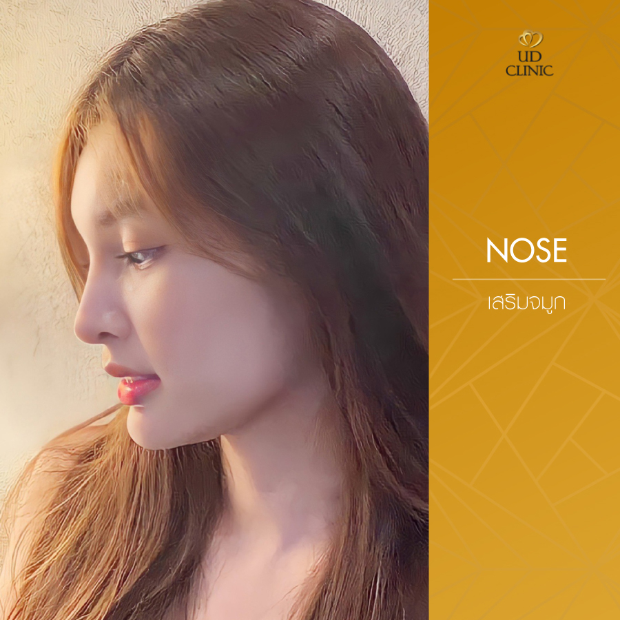 UD-Clinic-Review-Nose-127
