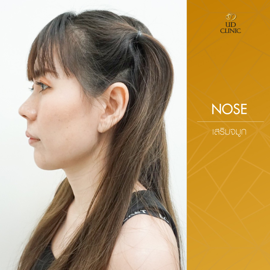 UD-Clinic-Review-Nose-128