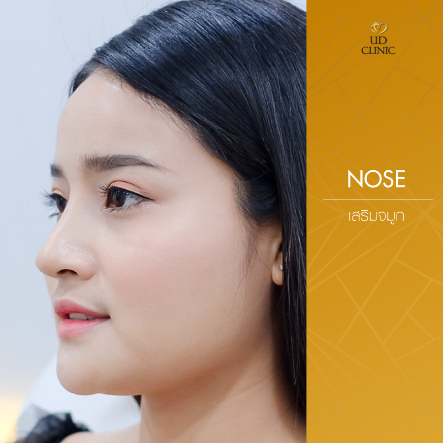 UD-Clinic-Review-Nose-129