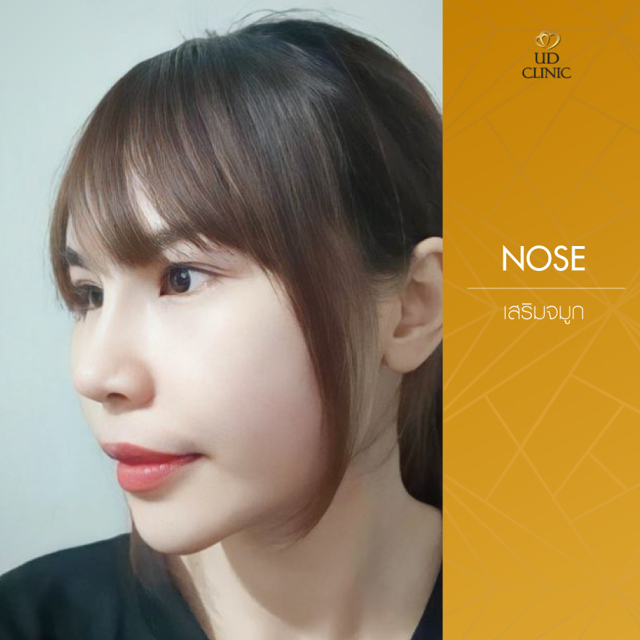 UD-Clinic-Review-Nose-132