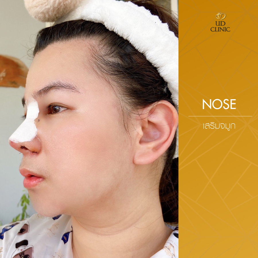 UD-Clinic-Review-Nose-134