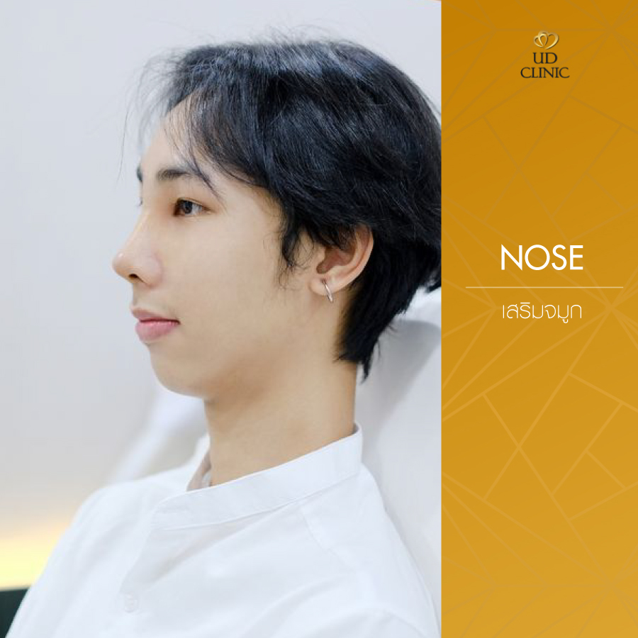 UD-Clinic-Review-Nose-136