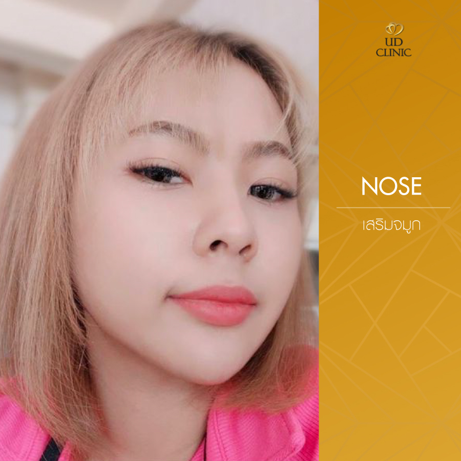 UD-Clinic-Review-Nose-137